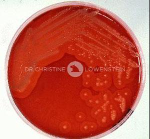 Abb. 1: Bakterienkultur